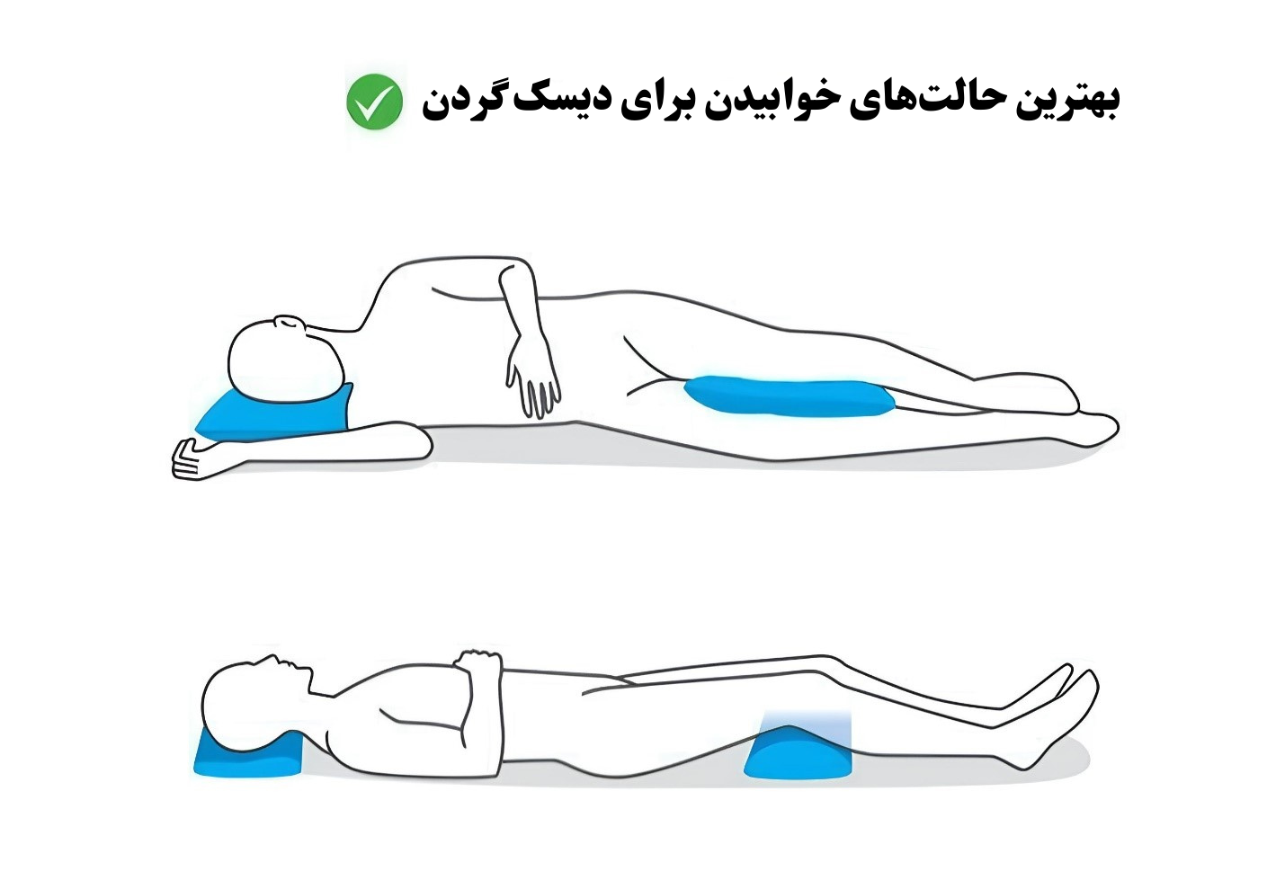 بهترین حالت‌های خوابیدن برای دیسک گردن