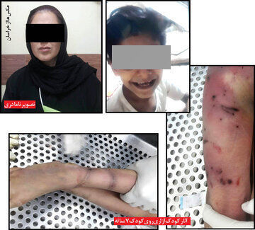 پسر 7 ساله زیر شکنجه‌های نامادری جان باخت + عکس 2