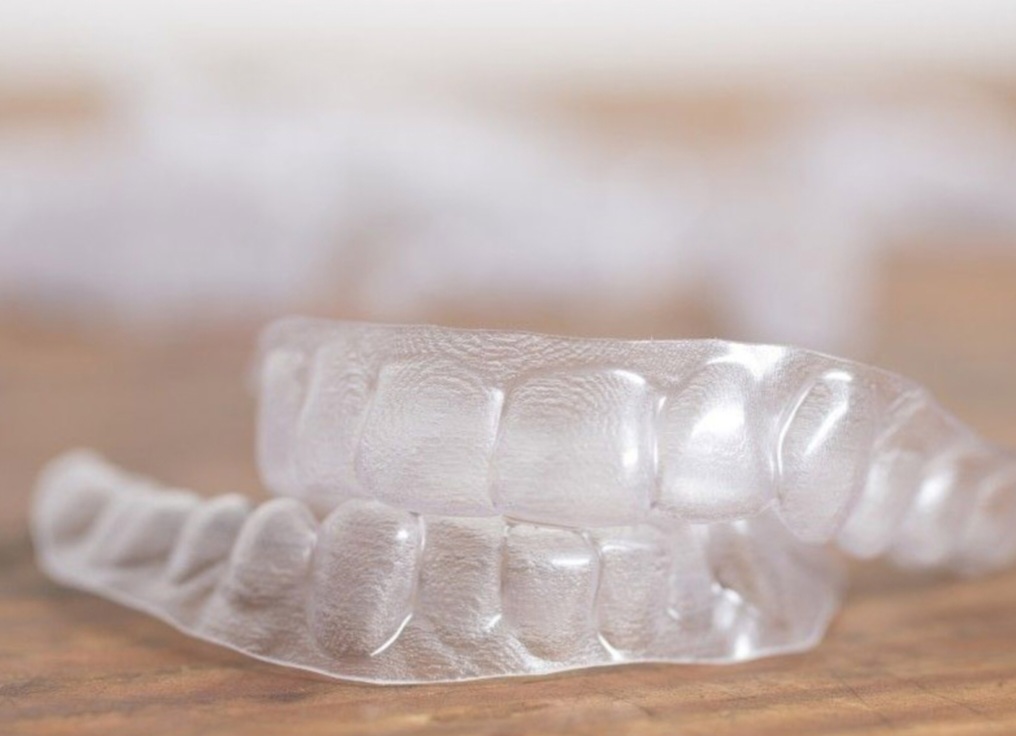 سرمایه گذاری ماندگار برای لبخندی زیبا؛ نگاهی اقتصادی و تخصصی به ارتودنسی دندان 3