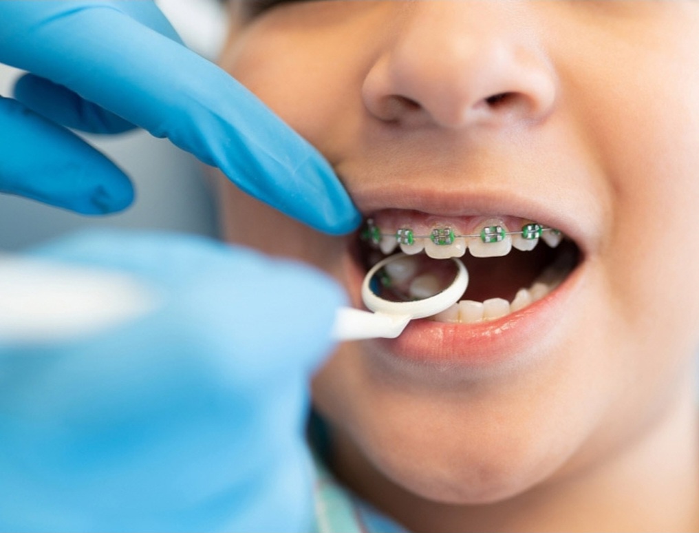 سرمایه گذاری ماندگار برای لبخندی زیبا؛ نگاهی اقتصادی و تخصصی به ارتودنسی دندان 2