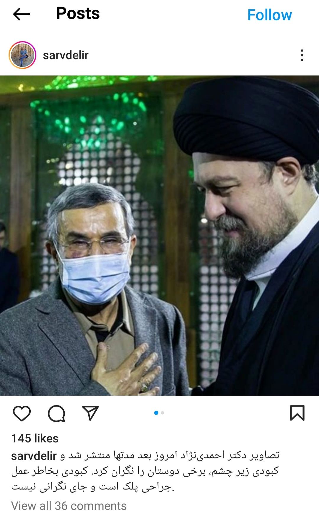 علت کبودی صورت احمدی نژاد مشخص شد + عکس 2