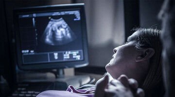 واکنش وزارت بهداشت به سقط جنین در خانه