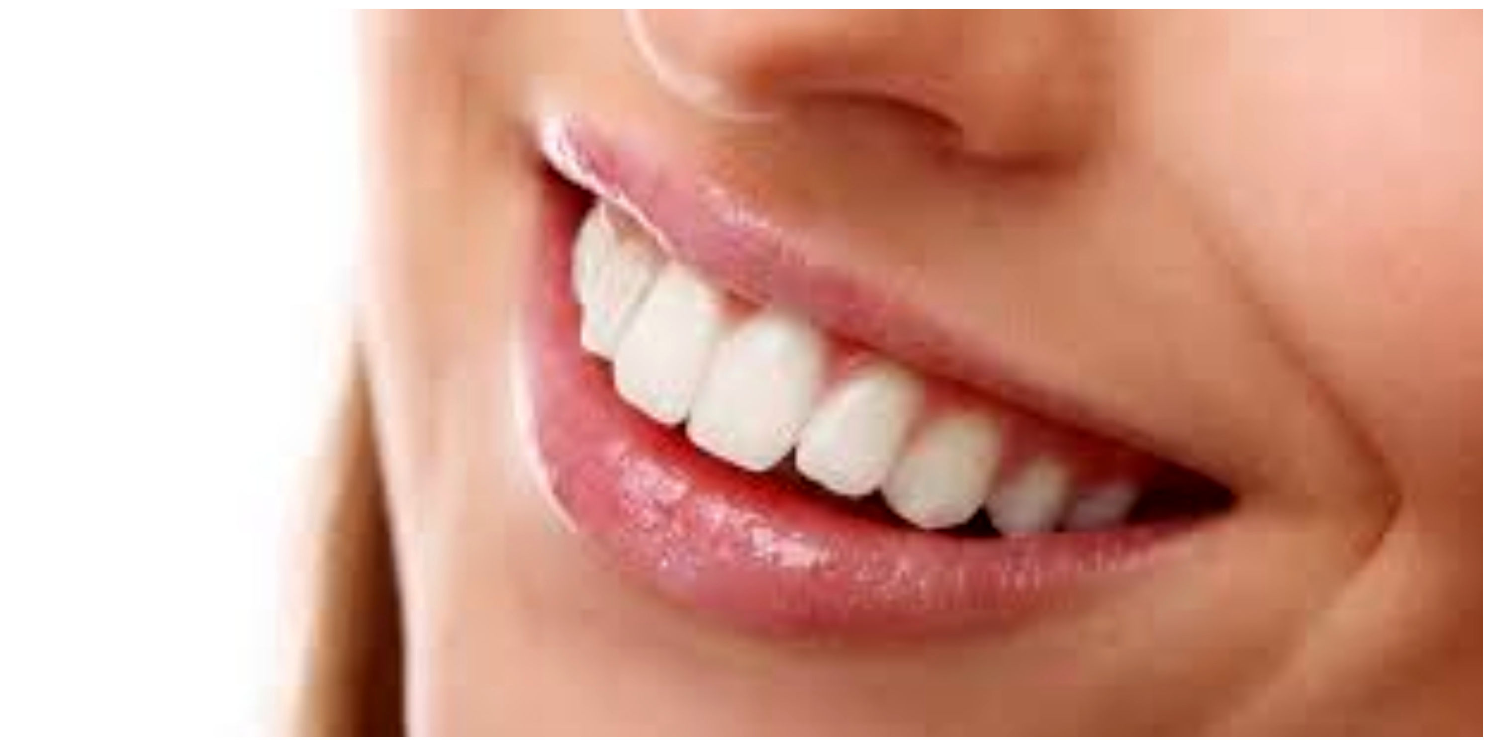 5 عادت غلطی که دندانتان را زرد می کند
