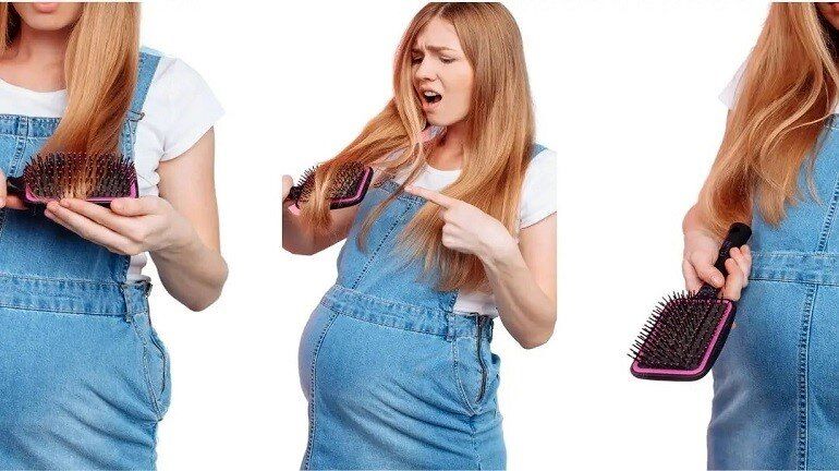 دلایل اصلی ریزش مو در دوران بارداری/ راهکارهای جلوگیری از ریزش مو