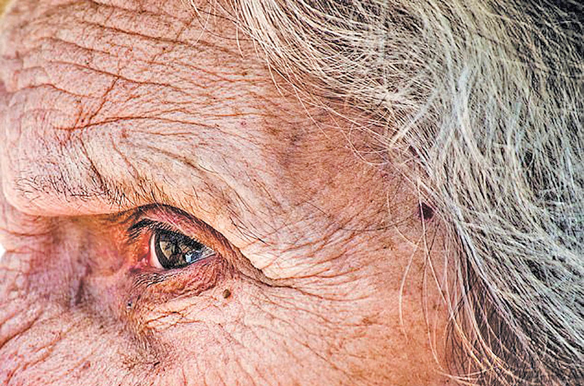 پیش‌بینی هوش مصنوعی از سن افراد با بررسی گوشه چشم