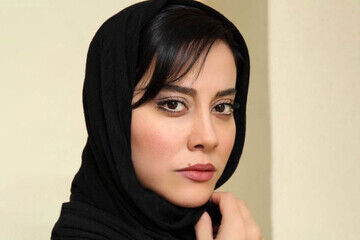 چهره خانم بازیگر پس از عمل جراحی+عکس