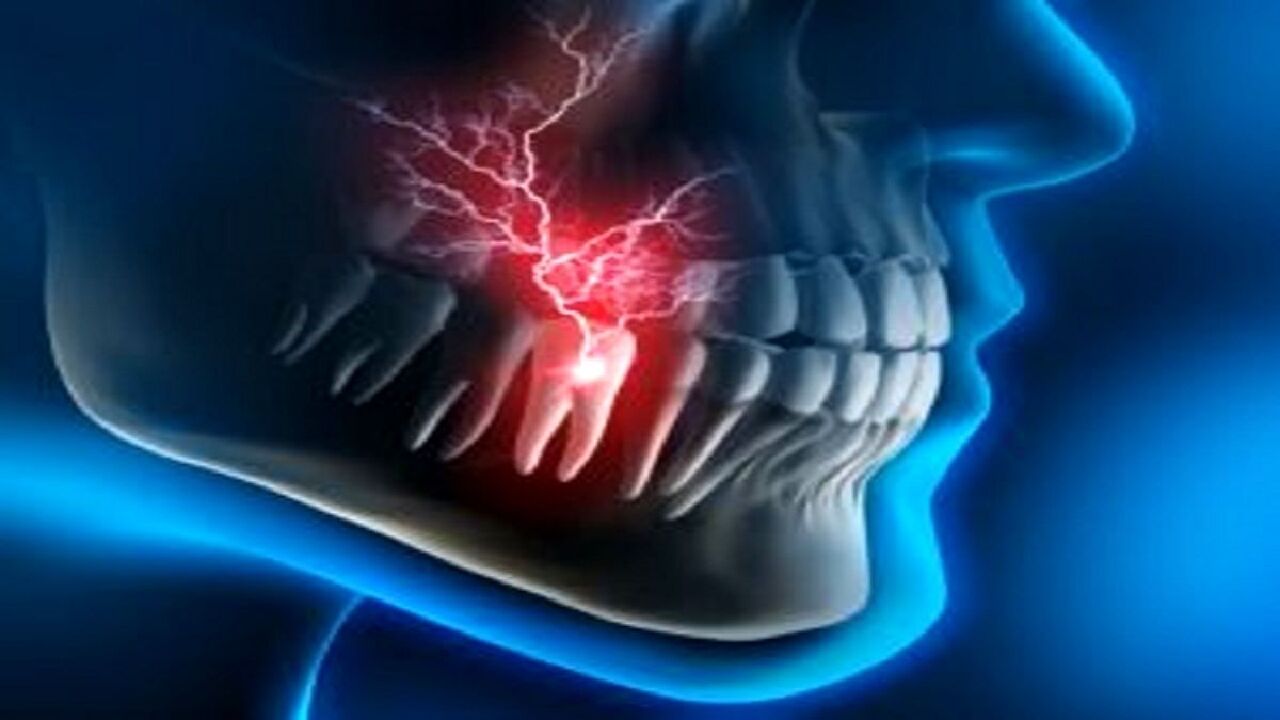 تأثیر فوق العاده این گیاه برای عفونت ریشه دندان!