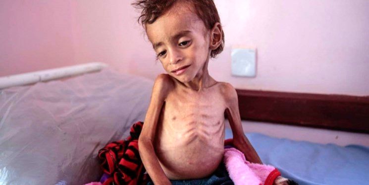 هشدار مقام یمنی نسبت به خطر مرگ جمعی میلیون‌ها کودک این کشور