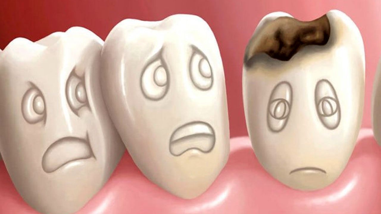 این خوراکی‌ها دندان شما را نابود می‌کنند