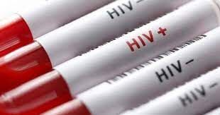 خبرخوش درباره درمان مبتلایان HIV در کشور