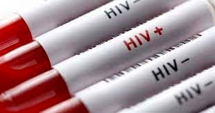 خبرخوش درباره درمان مبتلایان HIV در کشور