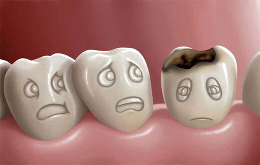 این خوراکیها سلامت دندانهایتان را تهدید می‌کند