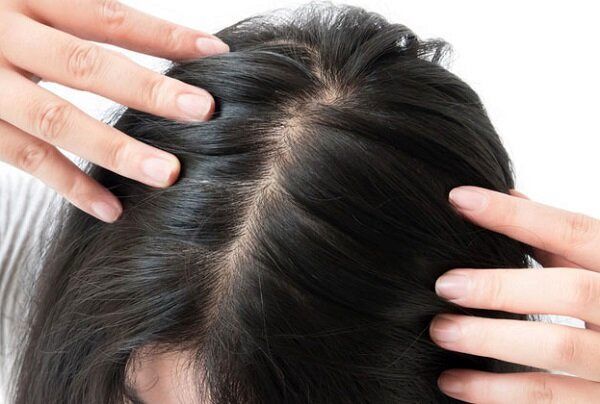 این 6 علامت در موهایتان یعنی بدن شما در خطر است