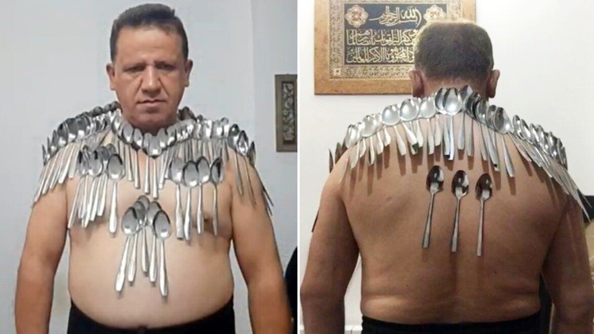 عجیب ترین رکوردهای گینس ۲۰۲۵؛ از نگه داشتن چوب کبریت در بینی تا خوک اسکیت‌باز