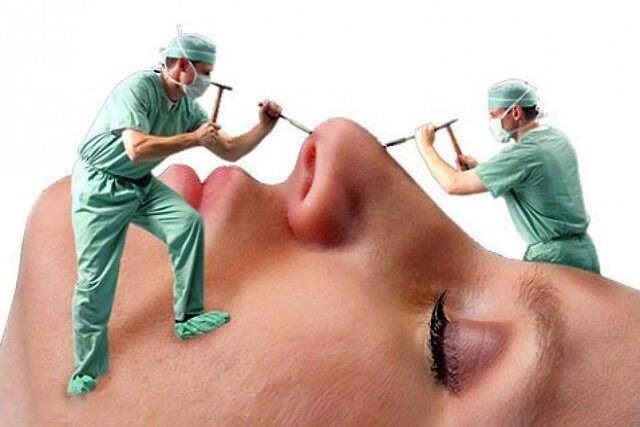 زنان جوان ایرانی صدرنشین عمل زیبایی در کشور / کم هزینه ترین جراحی زیبایی برای چیست؟