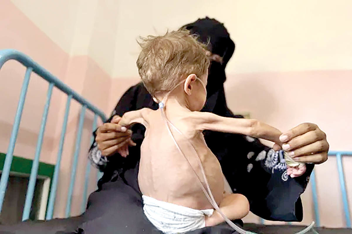 سازمان ملل رسما قحطی در غزه را تایید کرد
