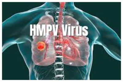 برای پیشگیری از ابتلا به ویروس HMPV چه کنیم؟