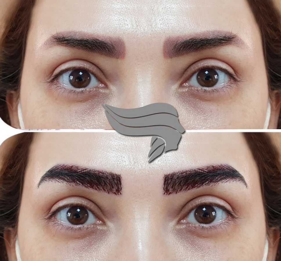 کاشت ابرو طبیعی پرتراکم برای زنان و مردان