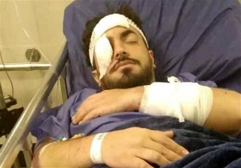 حمله به یک روحانی در تهران +عکس
