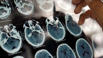 با خوردن این لبنیات پرطرفدار، با زوال عقل خداحافظی کنید