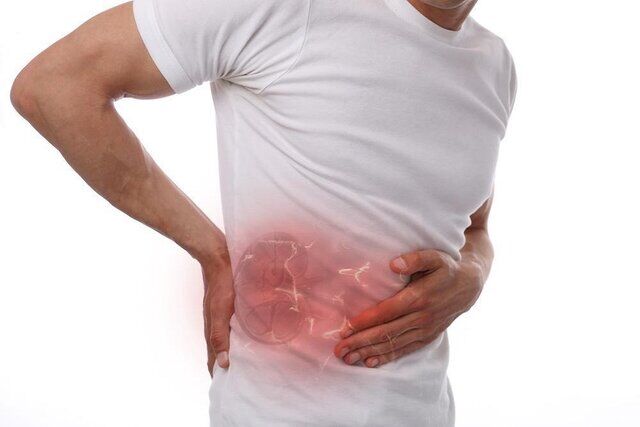چند راهکار ساده برای جلوگیری از ایجاد سنگ کلیه