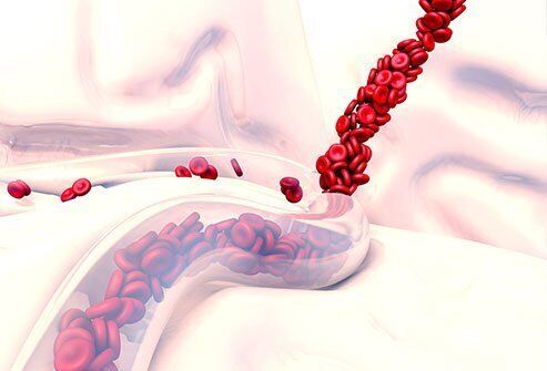 شایع ترین علائم خونریزی داخلی 