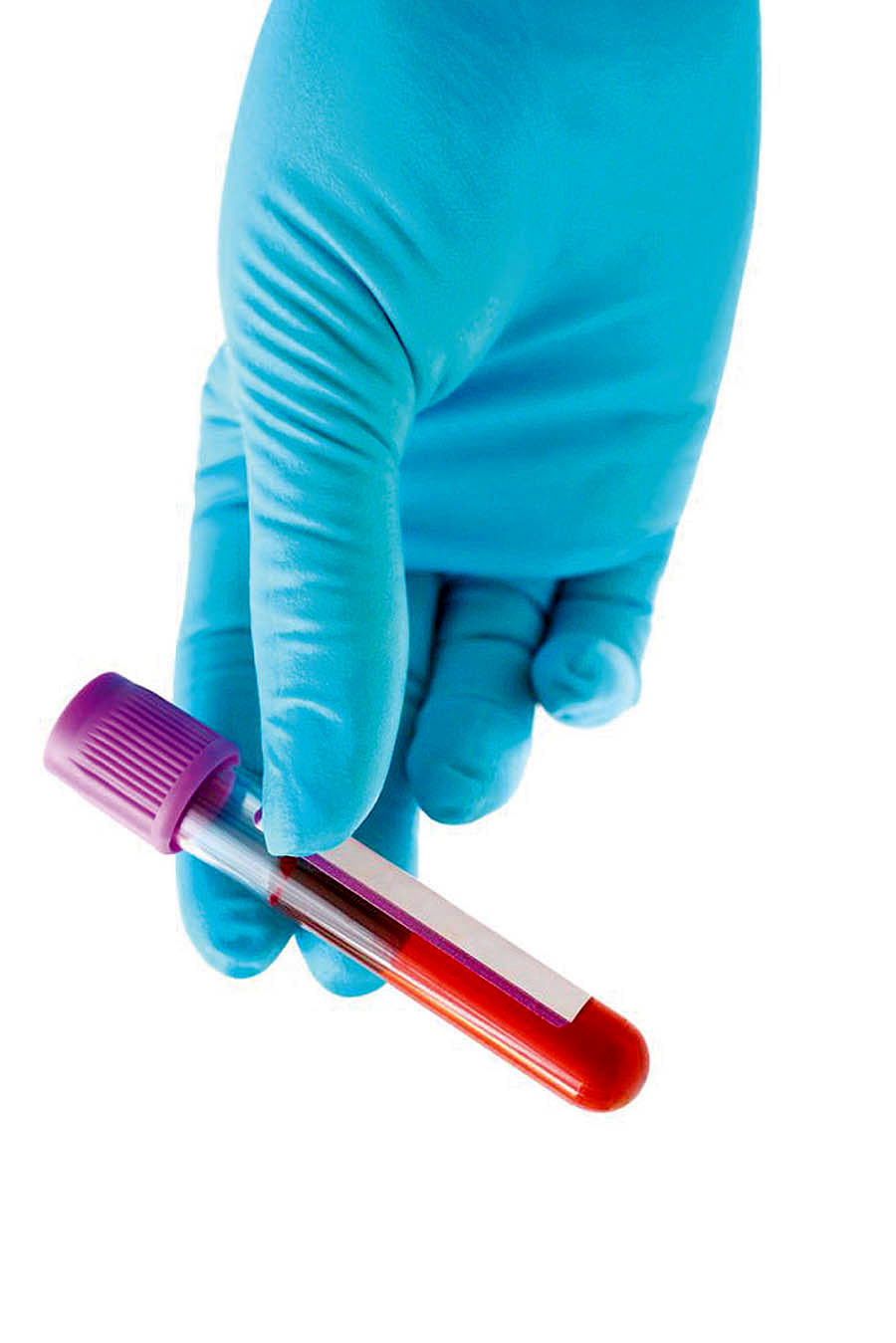 16 سوال مهم درباره آزمایش خون