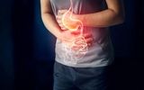 هشدار مینو محرز؛ این ساندویچ‌ها را از بیرون نخرید!