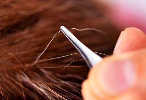 آیا می‌توان جلوی سفید شدن موها را گرفت؟/ دلیل سفیدی مو در نواحی شقیقه‌ها چیست؟/ چه دارو و مکملی اثر قطعی بر رفع سفیدی مو دارد؟