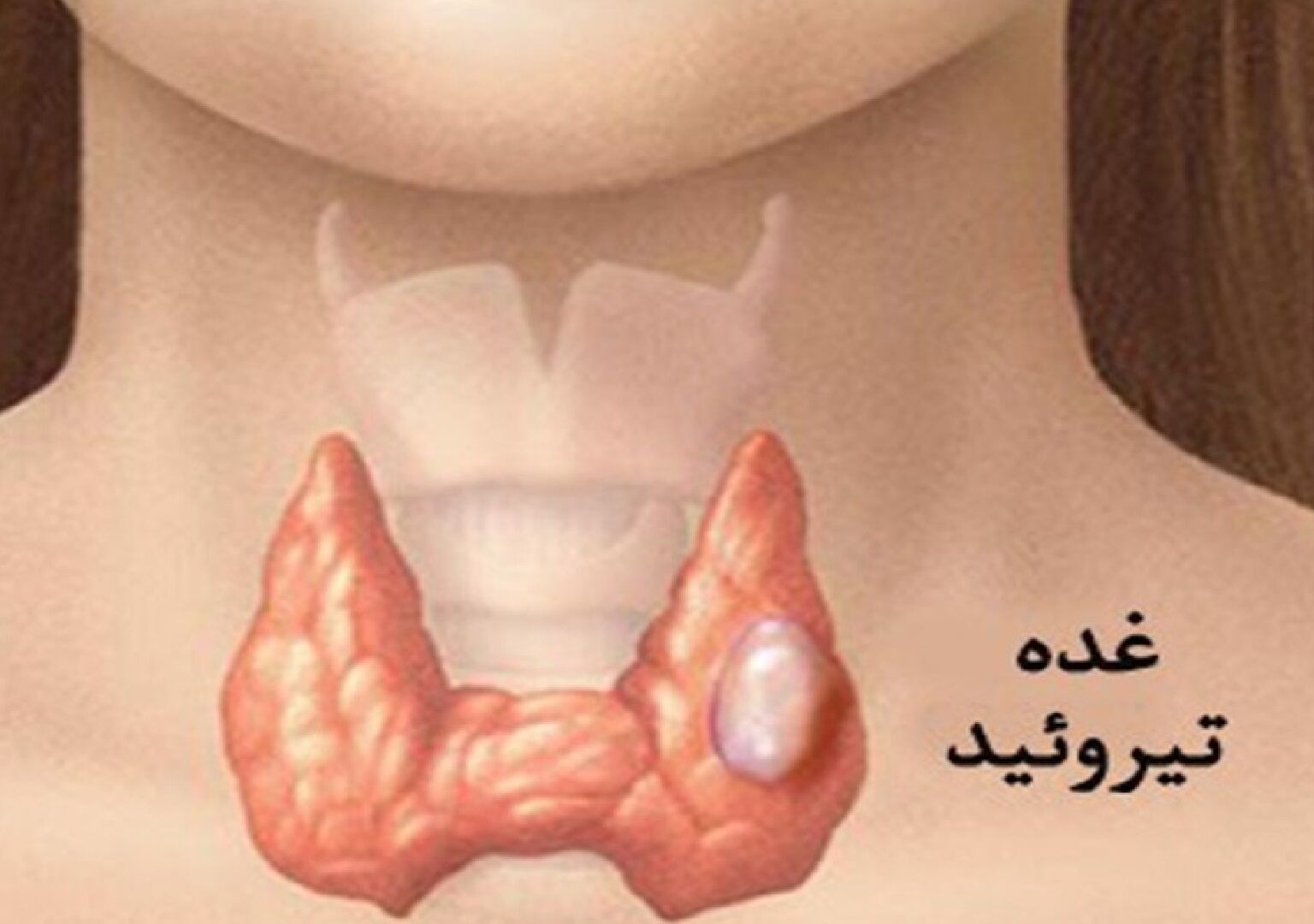 عواملی که باعث تیروئید می شود