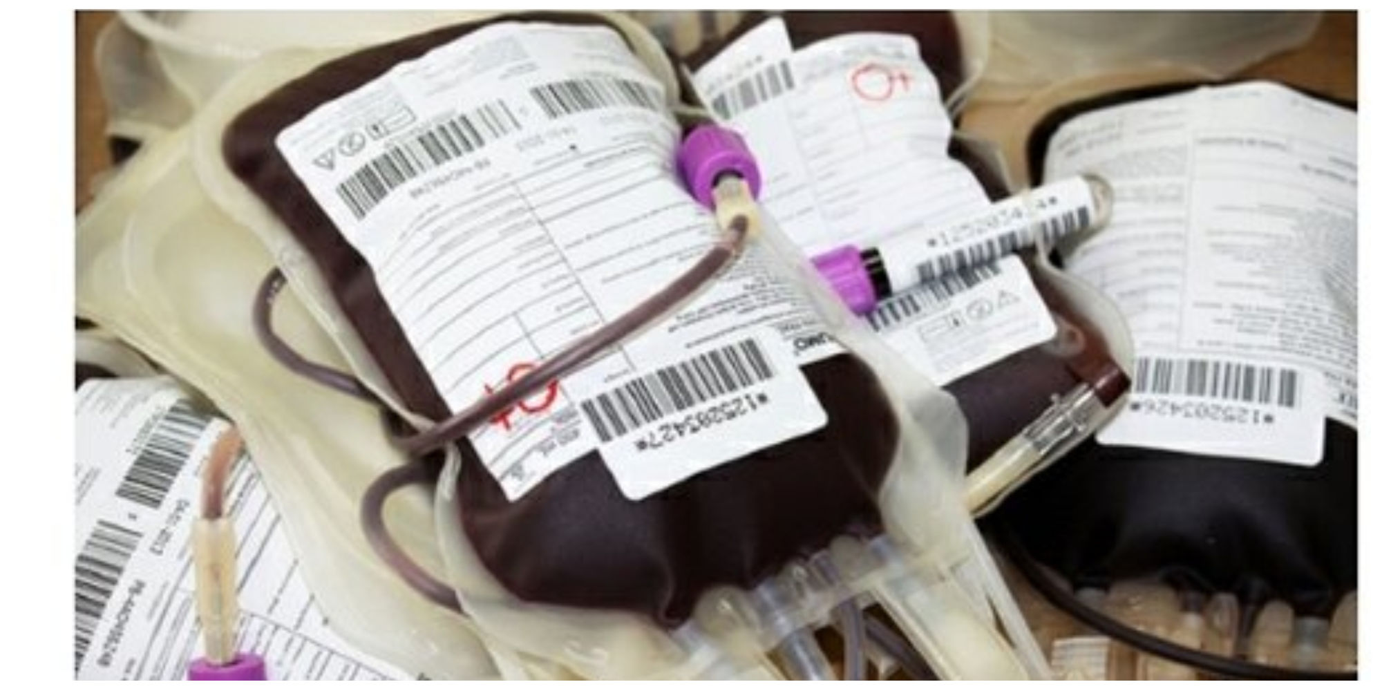 این گروه از خانم ها نمی توانند خون اهدا کنند!