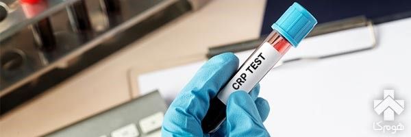 CRP در آزمایش خون چیست؟ + تفسیر نتایج آزمایش CRP