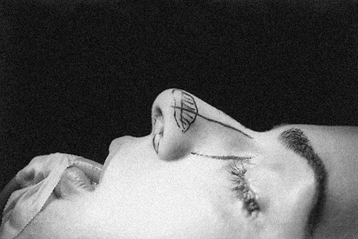 مخاطرات و هزینه‌های جراحی زیبایی 