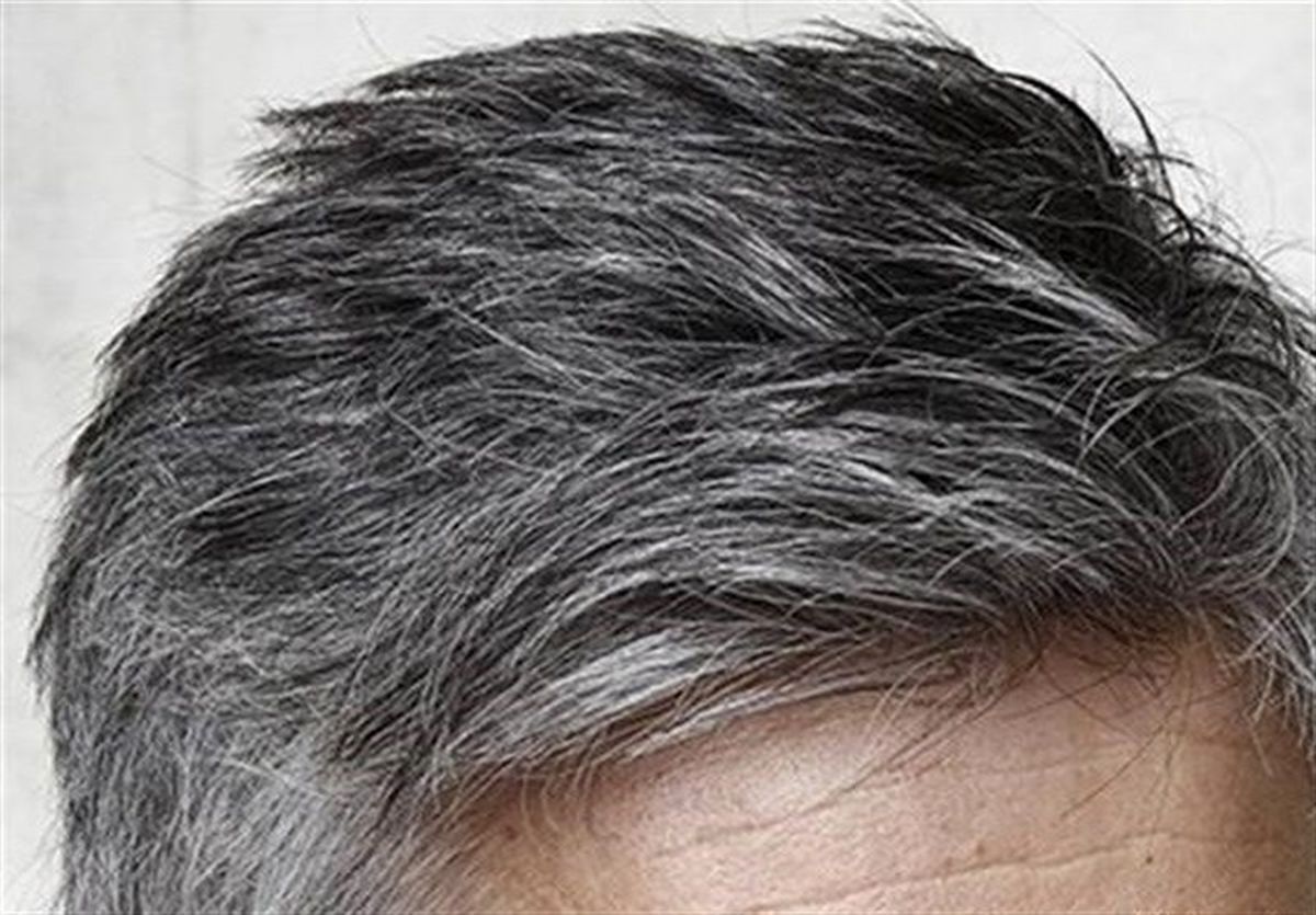 دلیل سفیدی مو در نواحی شقیقه‌ها/ آیا می‌توان جلوی سفید شدن موها را گرفت؟