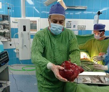 توده ۳/۵ کیلویی از کلیه یک بیمار  خارج شد+ عکس 
