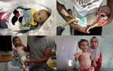 تصاویری تلخ از مرگ تدریجی یک نوزاد در غزه 