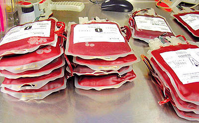 اهدای خون را به دو علت جدی بگیرید