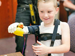 پیوند بازوی روباتیک چاپ شده  به پسر 6 ساله
