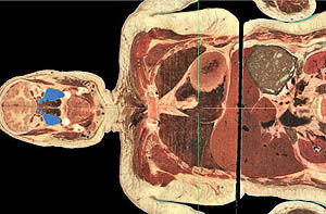 دقیق‏ترین تصویر دیجیتالی از بدن با جسدی که 5هزار تکه شد