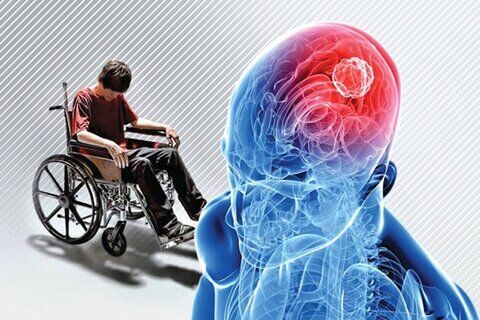 چه کسانی بیشتر دچار بیماری ام.اس می‌شوند؟