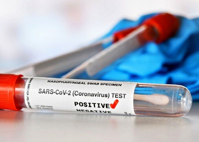 جزییات آمار تزریق دز سوم واکسن کرونا در کشور
