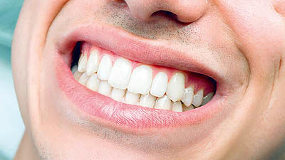 مواد غذایی مفید برای دهان و دندان