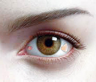 خطرات تغییر رنگ چشم و کاشت نگین در چشم