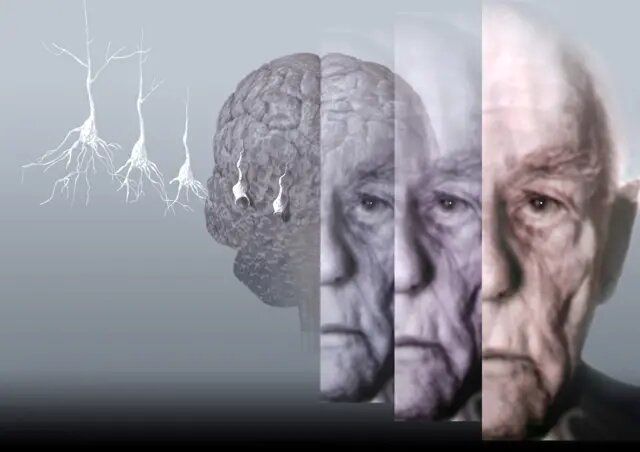 افشای فرمول پیشگیری از آلزایمر و پارکینسون / رژیم غذایی که باید رعایت کنید 2