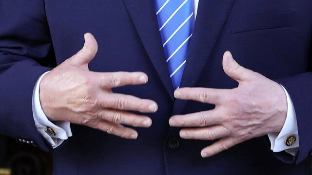 تلاش دیگر ترامپ برای پنهان کردن کبودی روی دستش