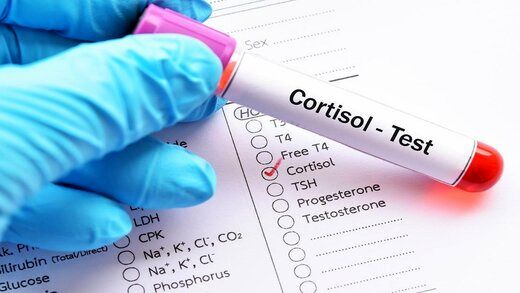 علائم بالا بودن سطح کورتیزول در بدن چیست؟