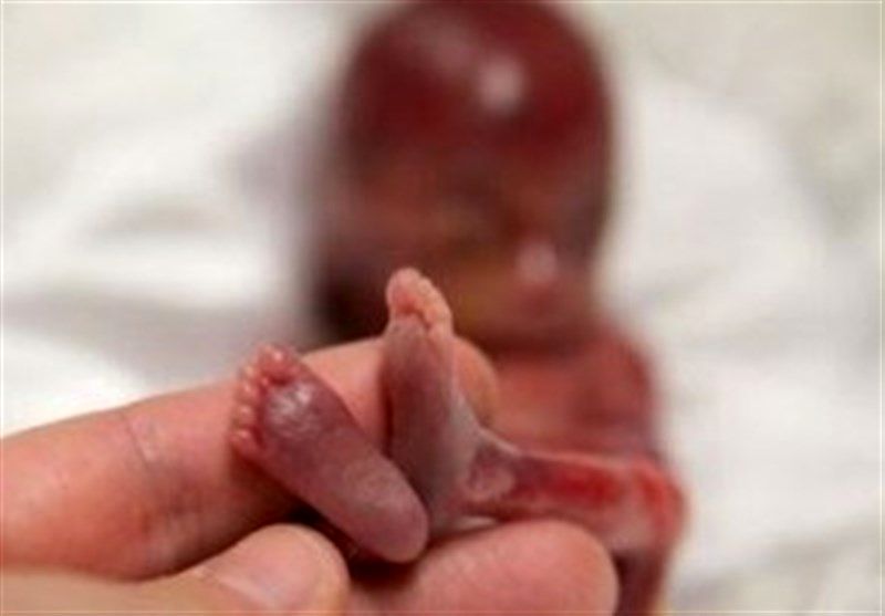 وزارت بهداشت: در صورت اثبات سقط جنین، پرونده مطب باطل می‌شود