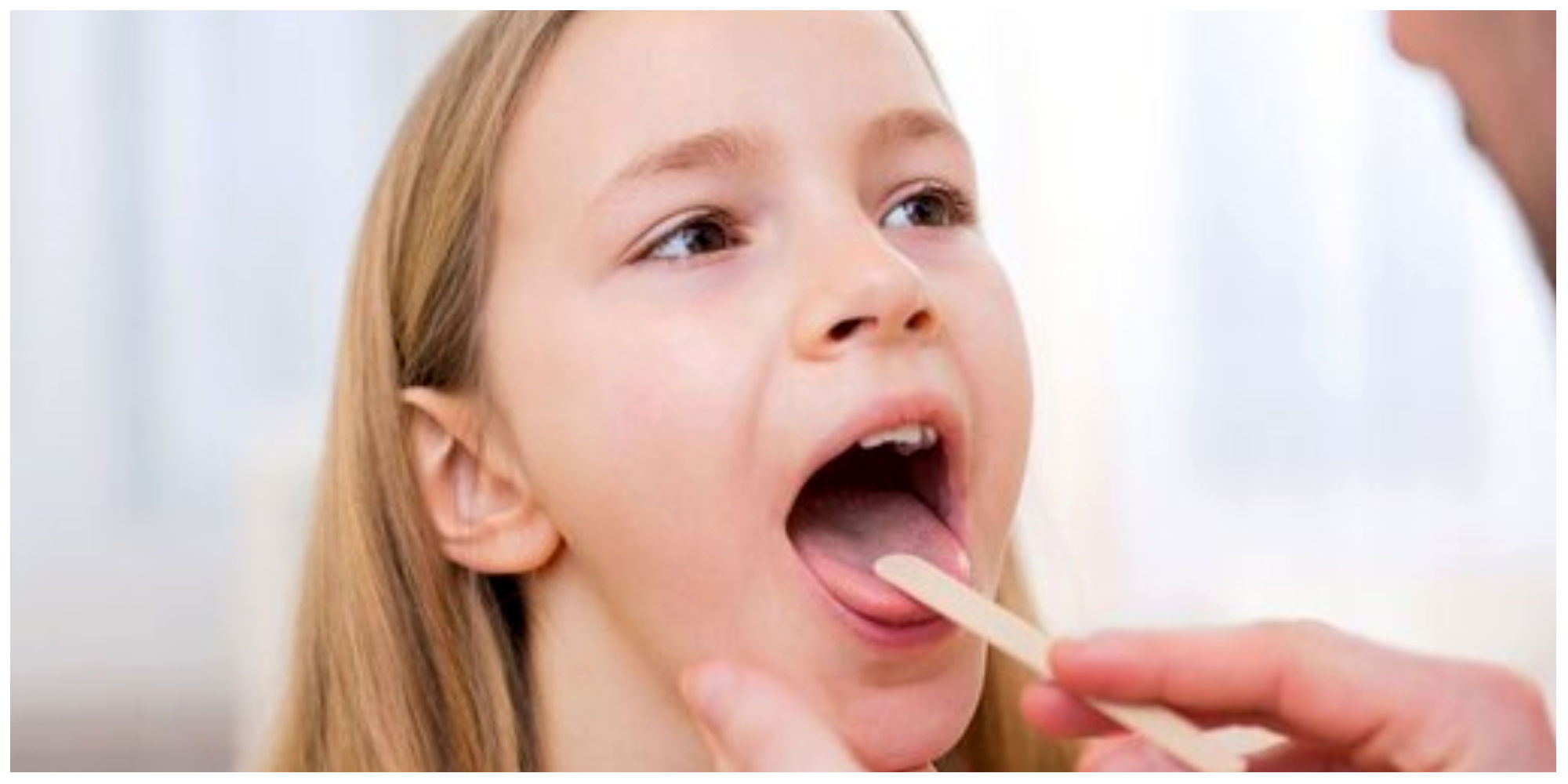 5 علامت مهم هشدار دهنده روی زبان برای سلامت بدن