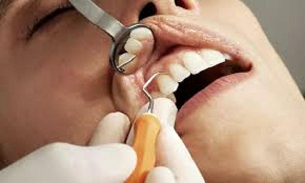 سلامت دهان و دندان روی میز وزارت بهداشت