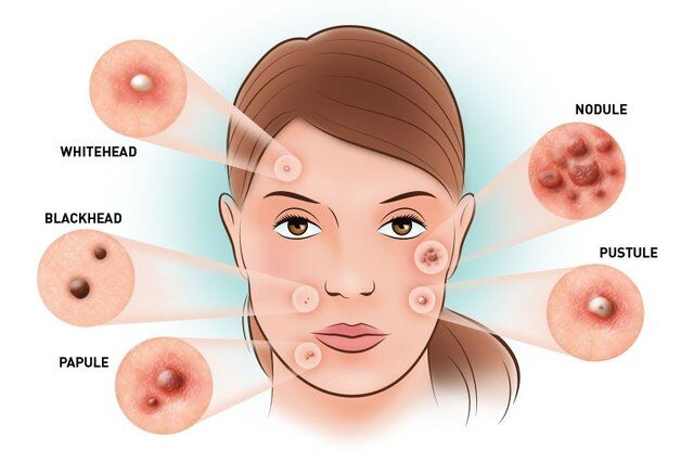 مضرات شستشوی بیش از حد صورت چیست؟